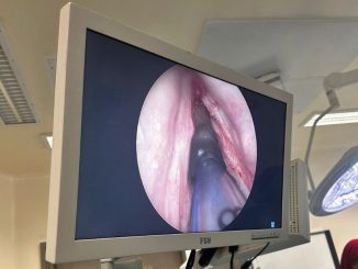 Tres cirugías de alta complejidad devuelven la voz y la confianza a pacientes del Hospital Regional de Antofagasta